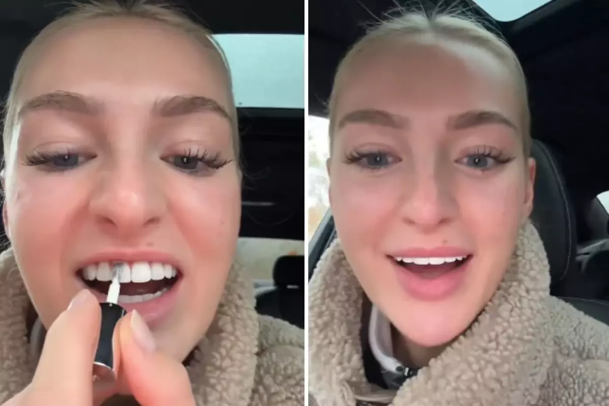 dislerini beyazlatmak icin yaptigi akilalmaz CGtTfhuO.jpg