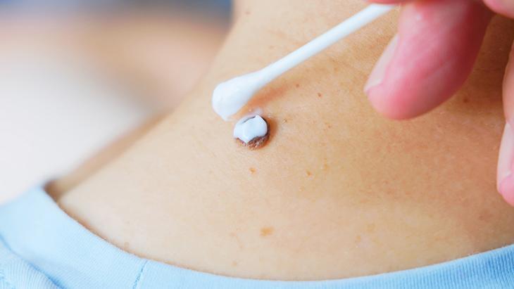 lazer de yaptiran da var solusyon suren de her ben masum degil incelenmeli dVMyhnd5.jpg